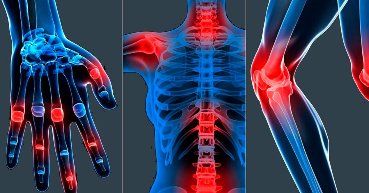 Indicazioni per l'uso dell'estratto di Boswellia in capsule