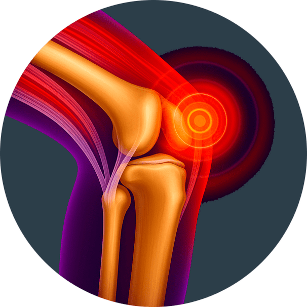 Infiammazione articolare